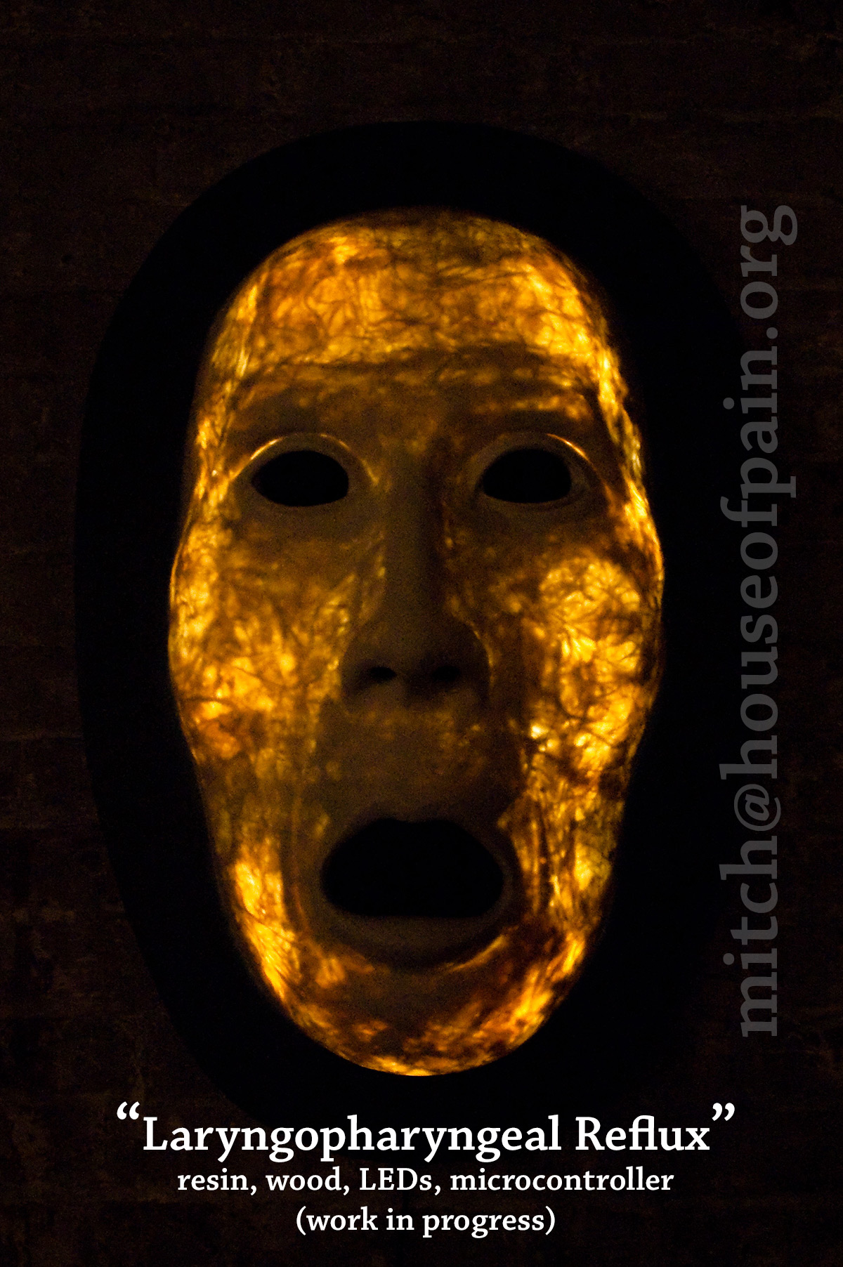 Laryngopharyngeal Reflux