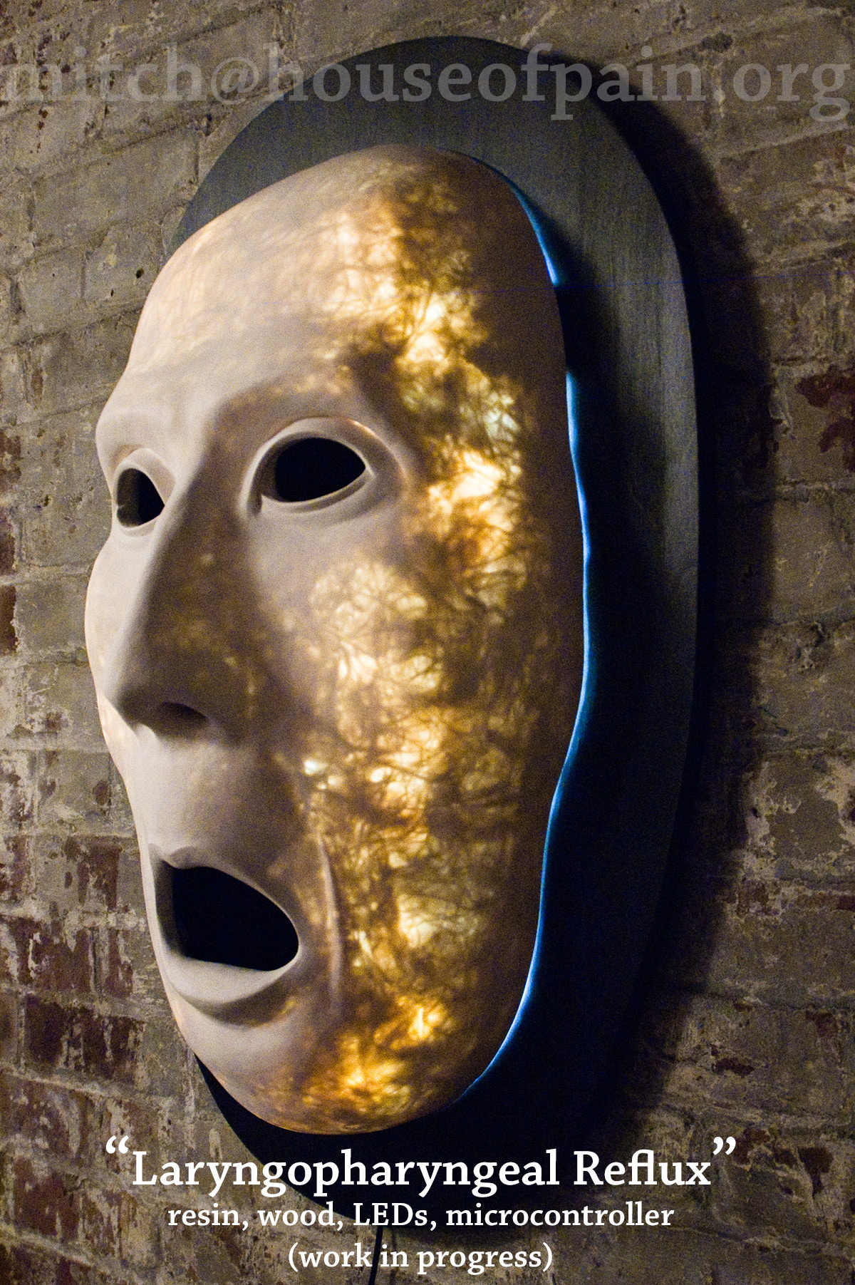 Laryngopharyngeal Reflux