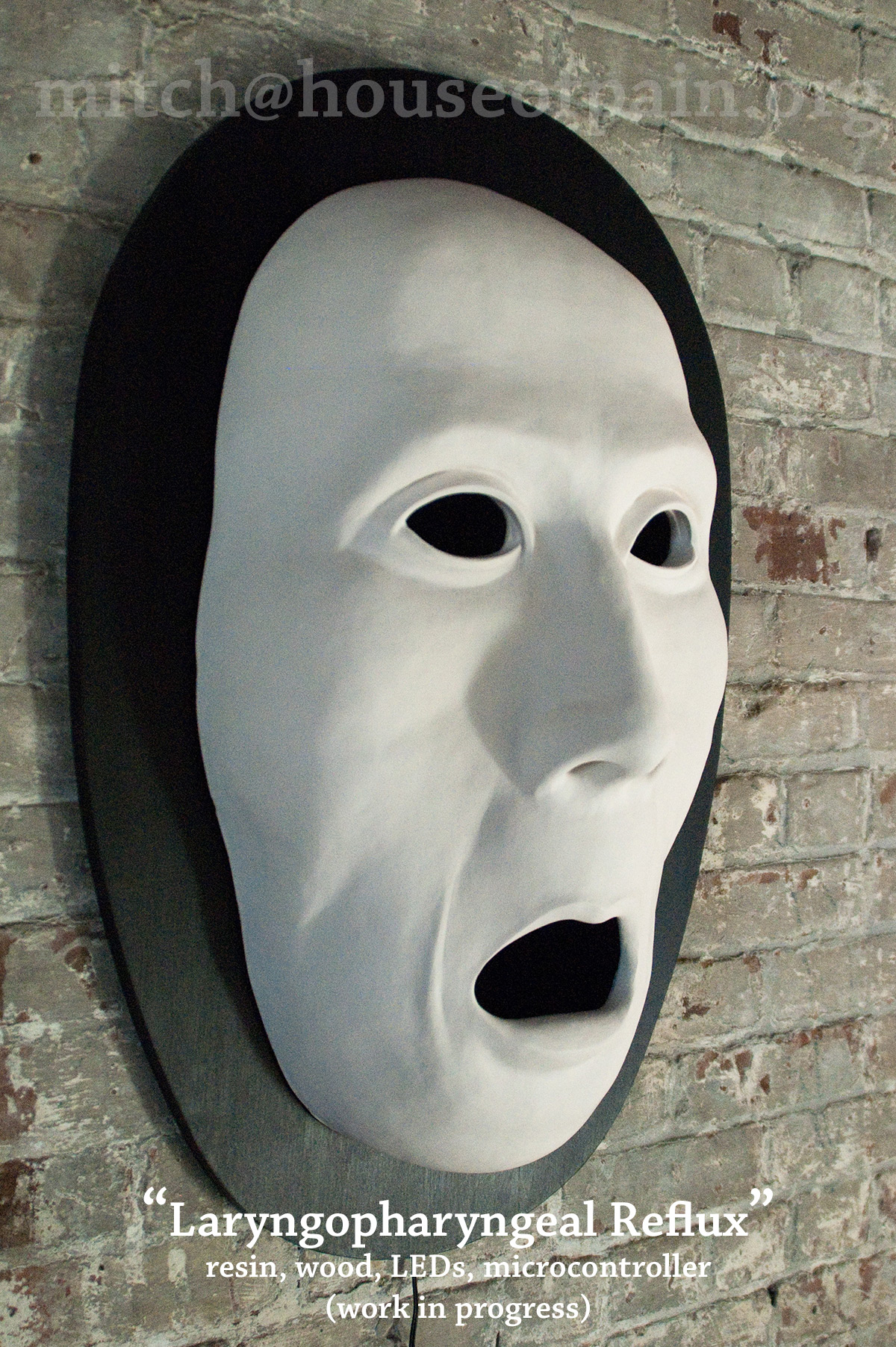 Laryngopharyngeal Reflux